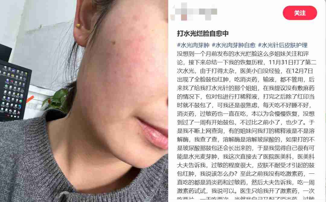 扎堆修复“烂脸”的年轻人,带火了医美新赛道