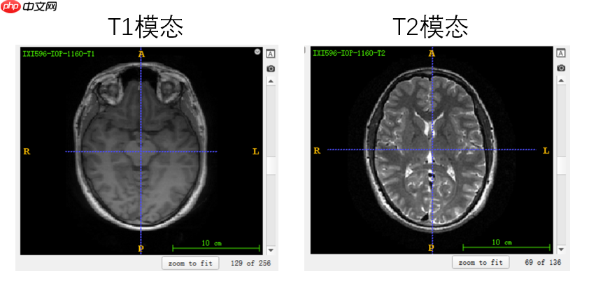 基于分割网络Unet生成虚拟图像