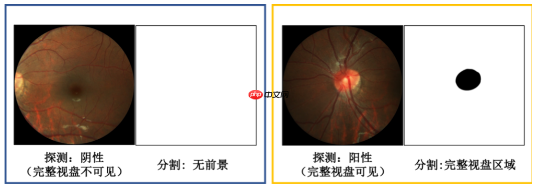 飞桨常规赛：PALM眼底彩照视盘探测与分割 - 5月第三名方案 - 创想鸟