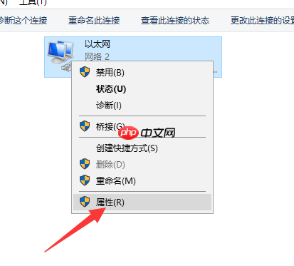 Win10系统以太网络电缆被拔出?