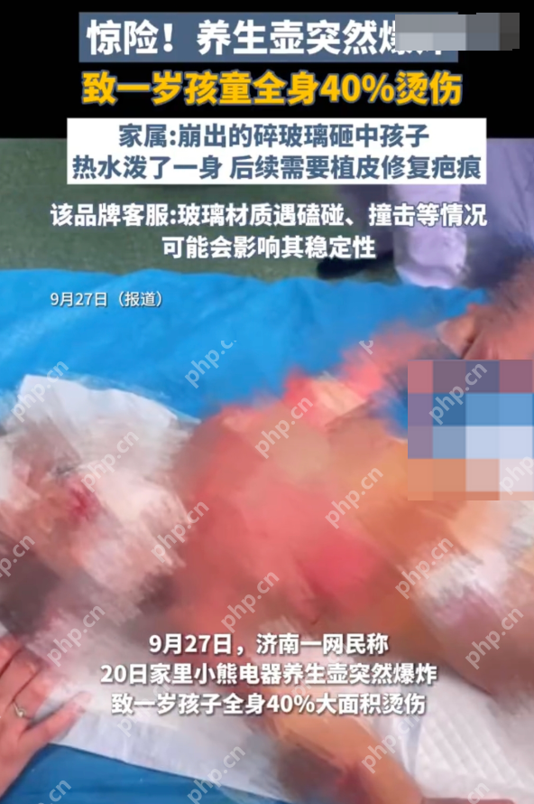 商家回应养生壶爆炸致1岁孩童烫伤:正在全力核查 - 创想鸟