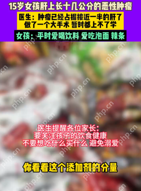 15岁女孩患癌肝被肿瘤占近半 女孩:平常爱喝饮料吃泡面辣条 - 创想鸟