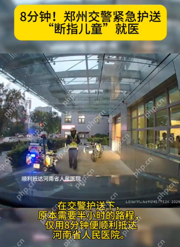 8分钟!郑州交警紧急护送 “断指儿童“ 就医 最新消息：两根手指已经接上了一根 - 创想鸟