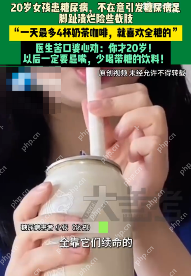 20岁女孩天天喝奶茶脚趾险截肢 女孩:全靠咖啡奶茶续命,最多一天4杯全糖 - 创想鸟