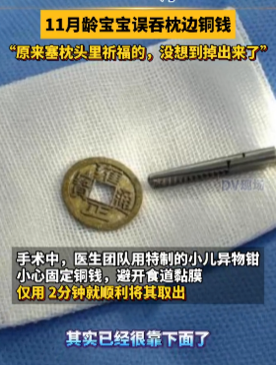 广州11月宝宝误吞枕边祈福币险窒息是怎么回事？详情介绍 - 创想鸟