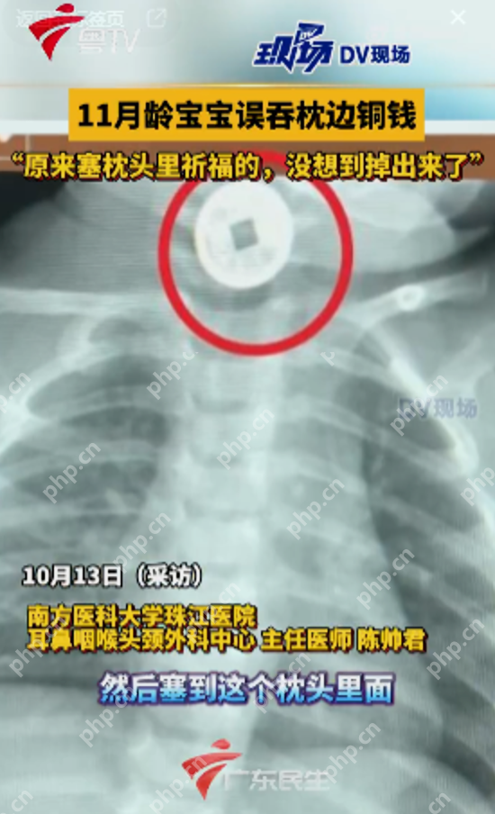 家长用铜钱当祈福币被宝宝误吞 医生提醒:“藏起危险”比任何祈福都更实际 - 创想鸟