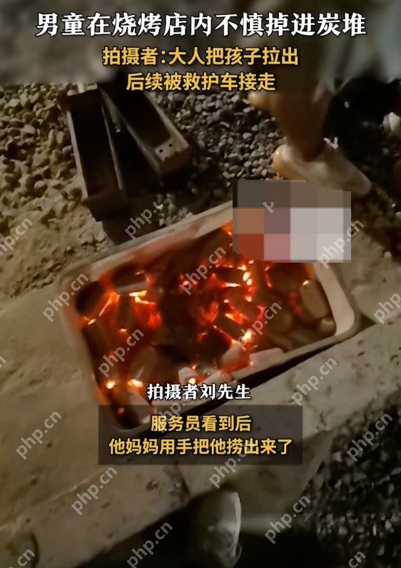 男童掉进烧烤店炭堆全身烧伤是怎么回事?详情介绍 - 创想鸟