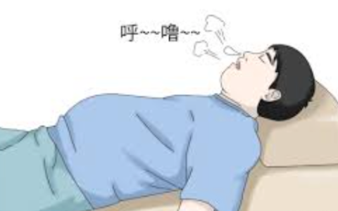 我国约1.7亿人患呼吸暂停综合征 睡眠呼吸暂停综合征有哪些