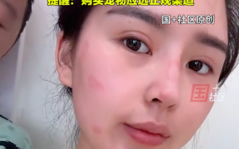 女子花2600元买猫后染上猫癣是怎么回事？详情介绍