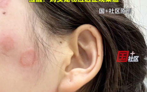 女子花2600元买猫后染上猫癣：买时猫就有猫癣，卖家称不用管能自愈