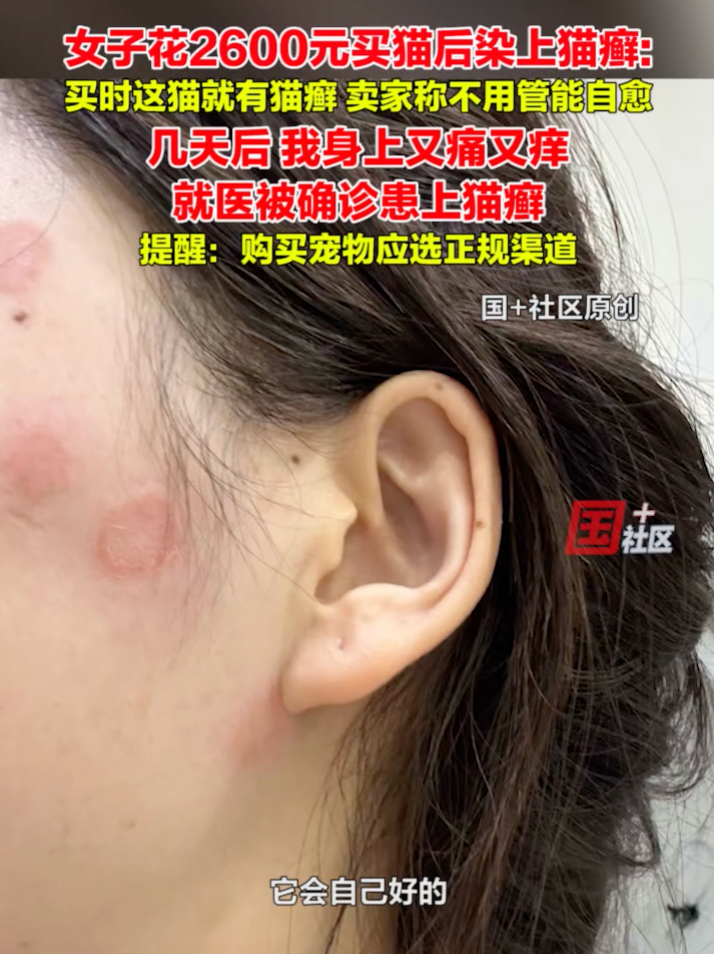 女子花2600元买猫后染上猫癣:买时猫就有猫癣,卖家称不用管能自愈 - 创想鸟