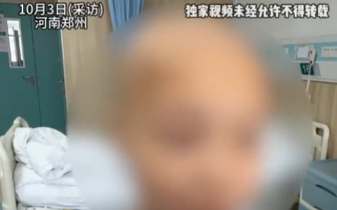 15岁女孩患癌肝被肿瘤占近半 女孩：平常爱喝饮料吃泡面辣条