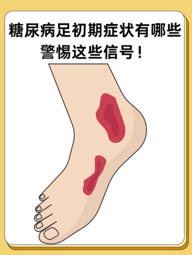 糖尿病男子管不住嘴10根脚趾被切除是怎么回事？详情介绍 - 创想鸟