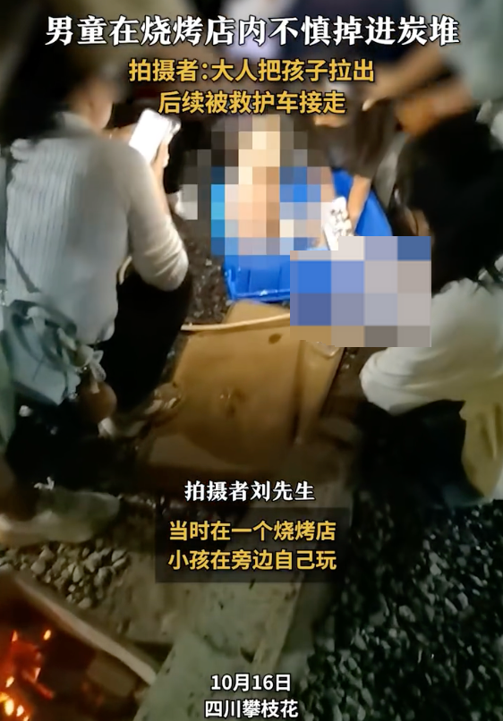 男童掉进烧烤店炭堆全身烧伤是怎么回事?详情介绍 - 创想鸟