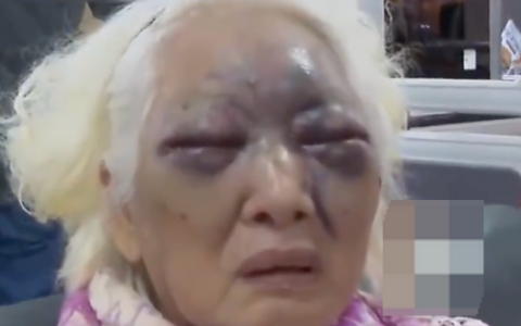 8旬阿婆被超市门口铁链绊倒摔断肋骨 超市负责人：警示牌被人挪开了