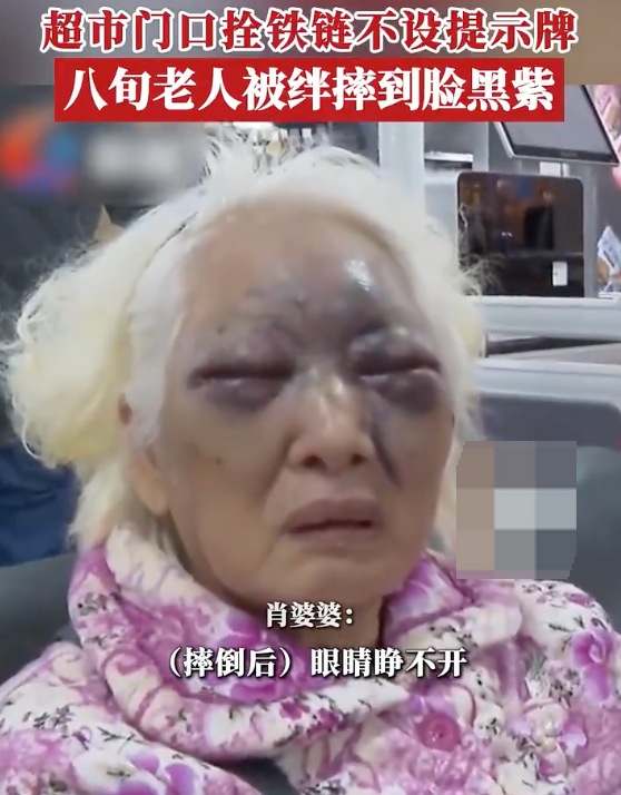 8旬阿婆被超市门口铁链绊倒摔断肋骨 超市负责人:警示牌被人挪开了 - 创想鸟