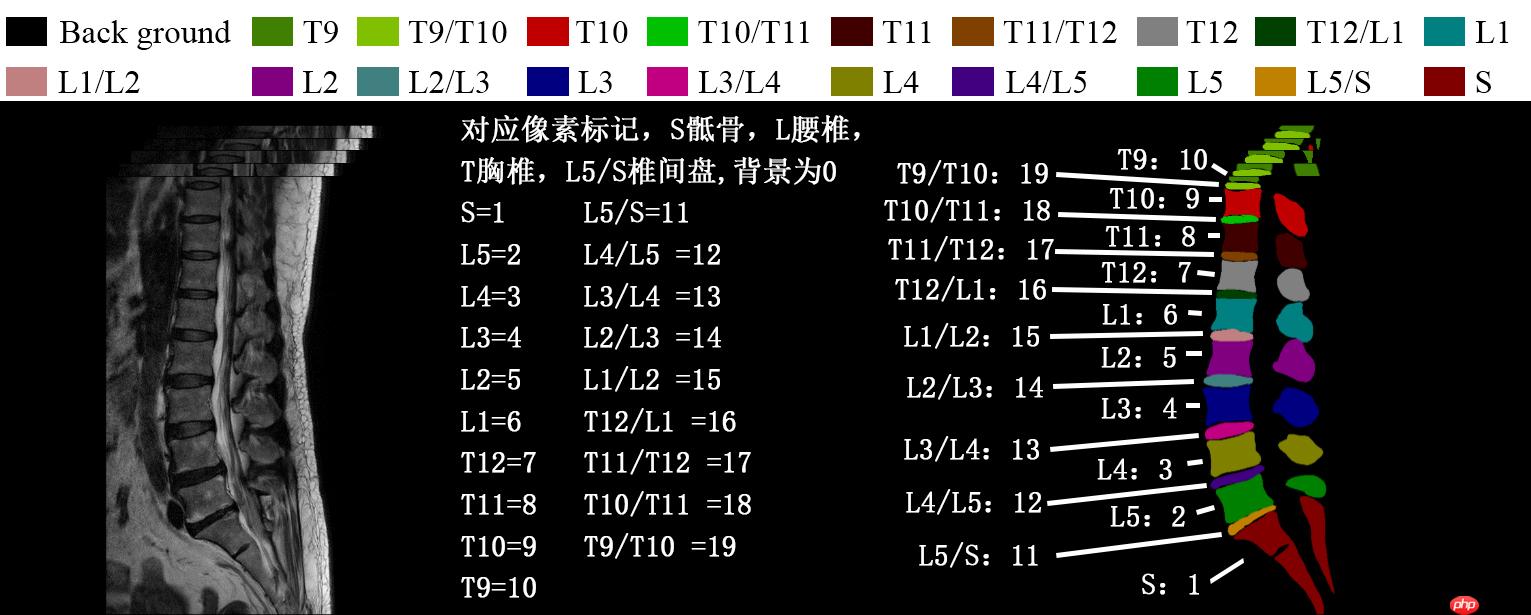 『医学影像』基于Unet+++实现脊柱MRI定位(上)