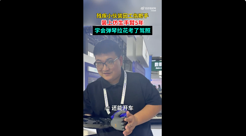 残疾小伙装上仿生手臂后弹琴考驾照：科技温暖生命 - 创想鸟