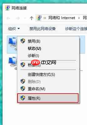 win10重装系统后不能上网,解决win10不能上网问题