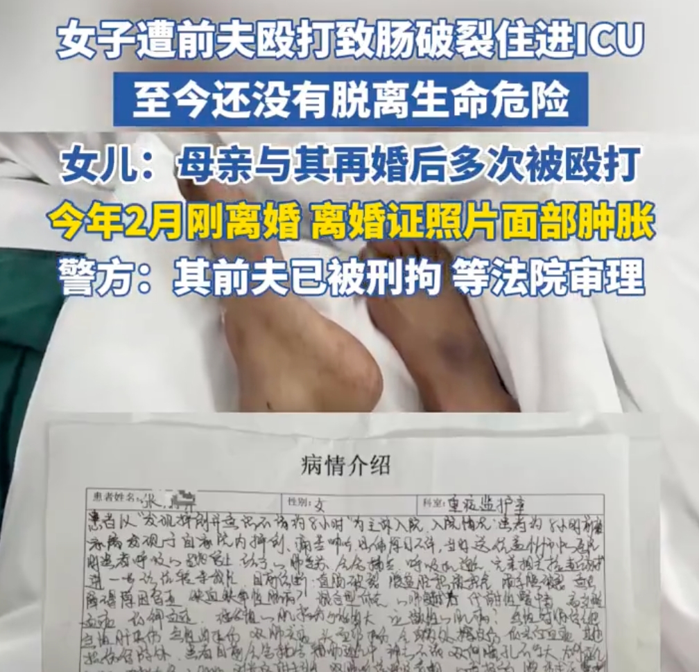 女子遭前夫殴打致肠破裂住进ICU 警方：嫌疑人已被刑拘 - 创想鸟