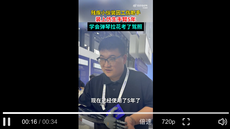 残疾小伙装上仿生手臂后弹琴考驾照：科技温暖生命 - 创想鸟