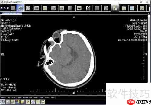 LEADTOOLS医学影像工作站使用教程