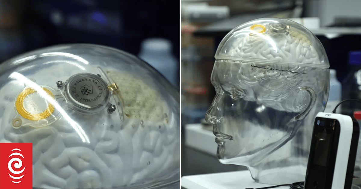 中国、脑机接口技术与Neuralink:一场通向未来的竞赛?