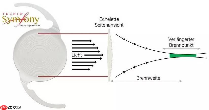 Symfony 怎么把序列化对象转为数组